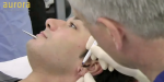 Aurora Clinics: Photo showing earlobe repair surgery