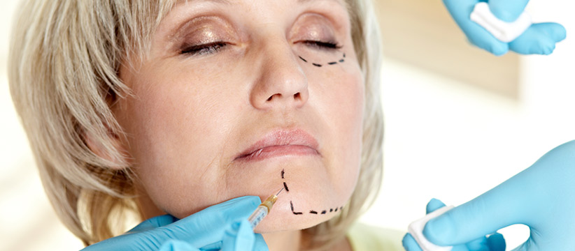 Aurora Clinics: Photo of Facelift Surgery