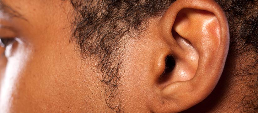 Aurora Clinics: Photo of Ear Pinning Surgery