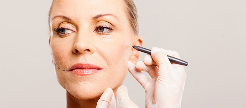 Aurora Clinics: Photo showing Short Scar Facelift surgery - alternative to a full facelift