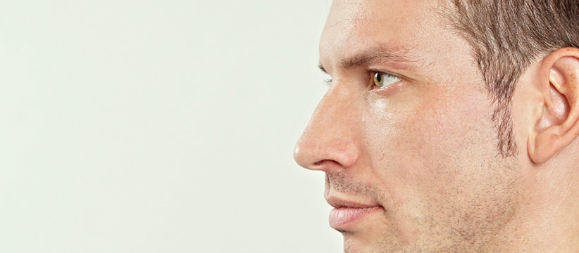 Aurora Clinics: Photo of Rhinoplasty Surgery