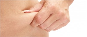 Aurora Clinics: Photo before Tummy Tucks Surgery