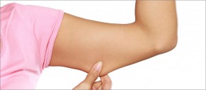 Aurora Clinics: Photo of Arm Lift Surgery