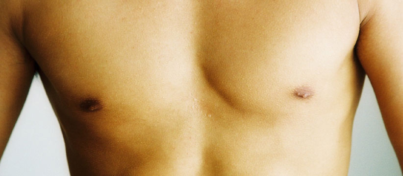 Aurora Clinics: Photo of Nipple Reduction Surgery