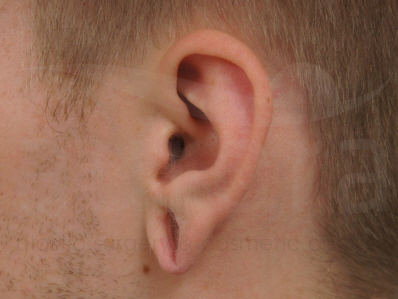 Before-Tribal Ears