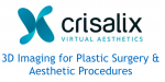 Aurora Clinics: Crisalix surgery simulator