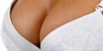 Aurora Clinics: Photo showing results of breast reduction surgery