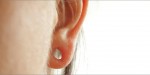 Aurora Clinics, Image showing Earlobe-Repair